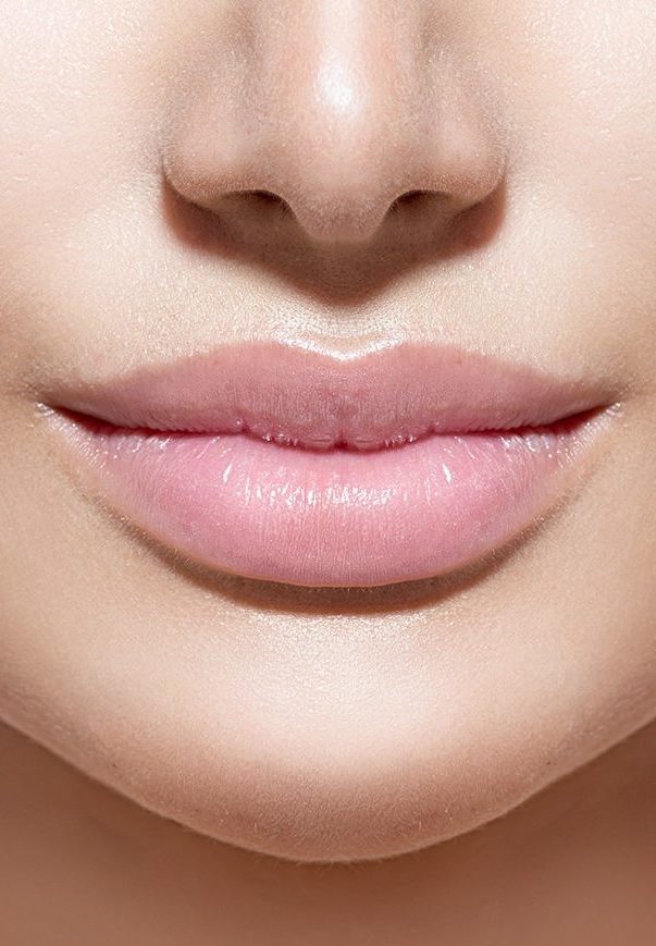 Lippen-aufspritzen-Lippenunterspritzung-Hyaluronsäure